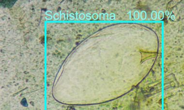 800-600-AI-prototype-identified-schistoma-egg-with-100-percent-certainty.jpg